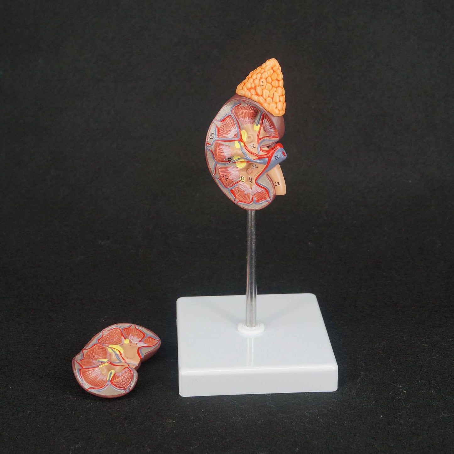 Human Kidney with Adrenal Gland Anatomical Medical Model Urology Anatomy - KiwisLove