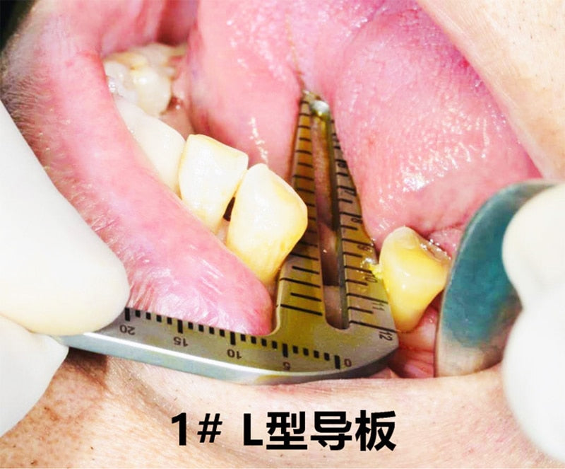 Dental Implant Guide Set Oral Planting Locator Positioning - KiwisLove