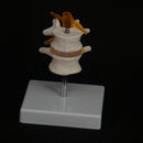 Life Size Two Section Lumbar Spine Skeleton Model with Stand - KiwisLove