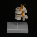 Life Size Two Section Lumbar Spine Skeleton Model with Stand - KiwisLove