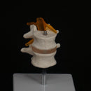 Life Size Two Section Lumbar Spine Skeleton Model with Stand - KiwisLove