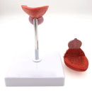 Natural Life Size Anatomical Human Urinary Bladder Prostate Model - KiwisLove
