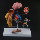 Human Diabetes Model Complications Cerebral Cardiac Pancreas Neuronal Foot - KiwisLove