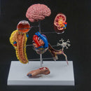 Human Diabetes Model Complications Cerebral Cardiac Pancreas Neuronal Foot - KiwisLove