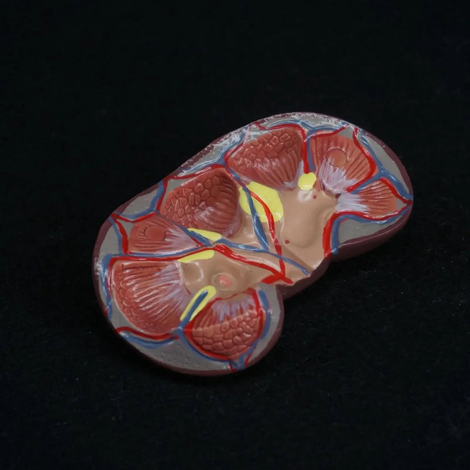Human Kidney with Adrenal Gland Anatomical Medical Model Urology Anatomy Natural Life Size Teaching Resources - KiwisLove