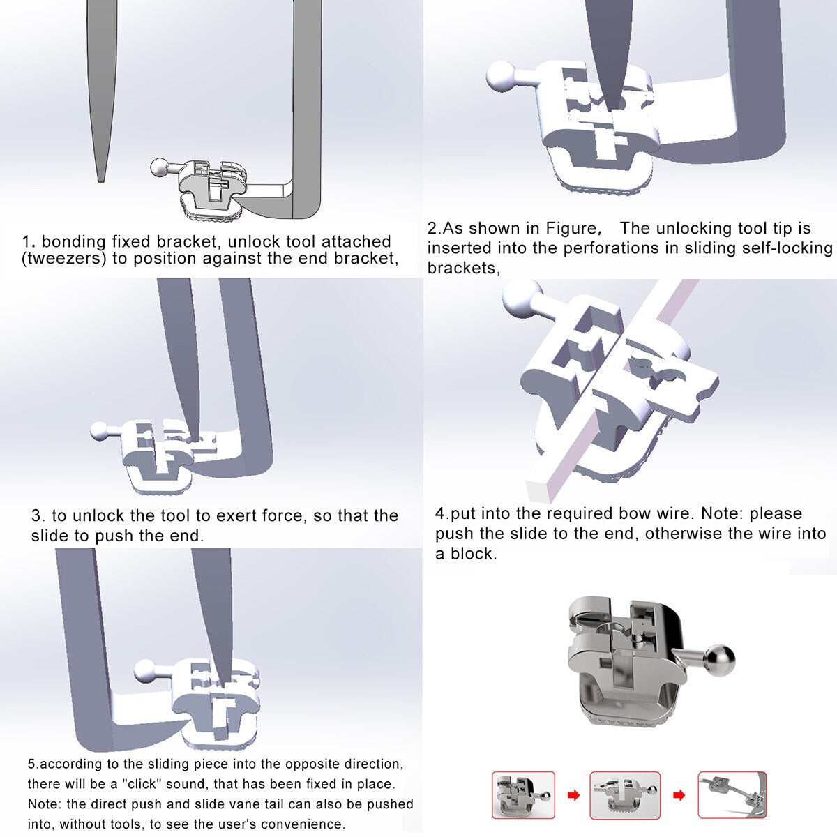 Dental Orthodontic Passive Self Ligating Bracket Roth.022 Hooks 345 with 1st Molar Buccal Tube - KiwisLove