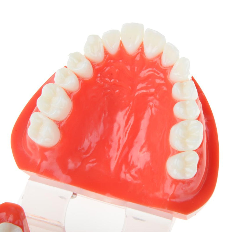 Dental Prosthesis Teeth Model Denture Teaching Dentist Simulator Technician Tools - KiwisLove
