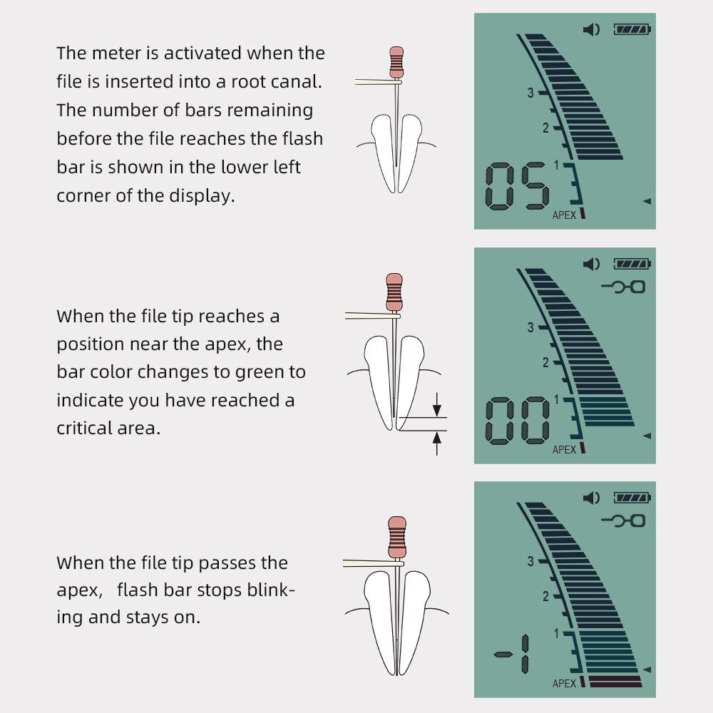 Azdent Dental Laboratory Endodontic AL-Micro Mini Endo Apex Locator Root Canal Instruments  - KiwisLove