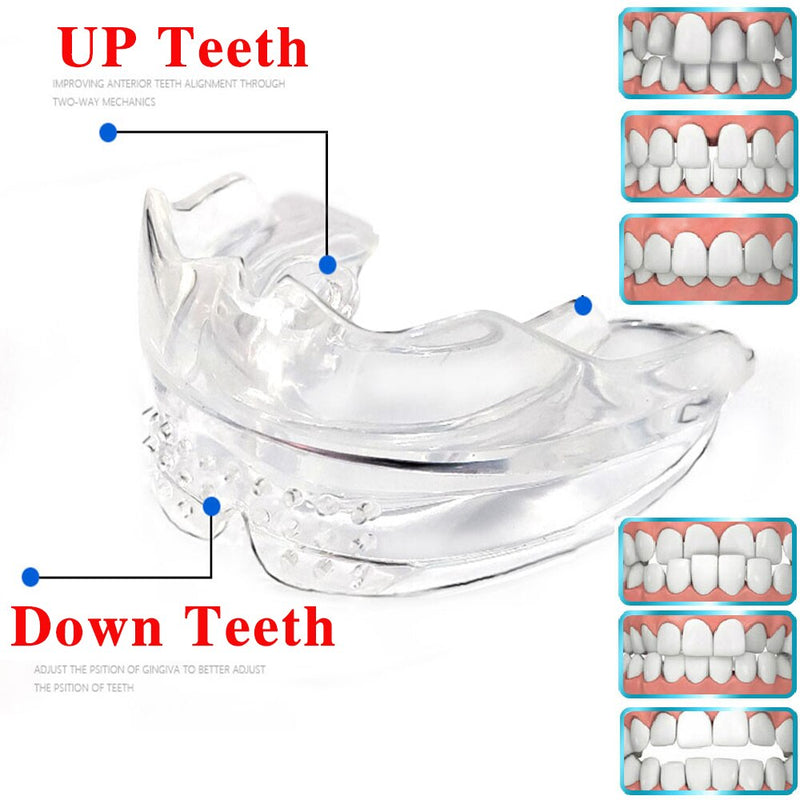 Azdent Dental Tooth Orthodontic Appliance Trainer Dental Braces Teeth Trainer For Adults Orthodontic Braces - KiwisLove