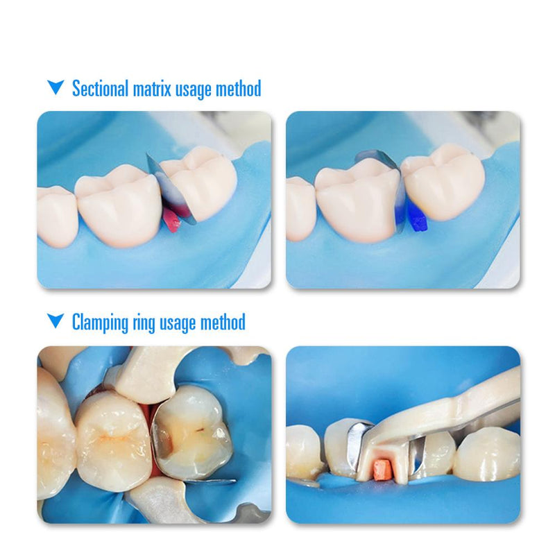 Dental Sectional Matrix System Band Metal Resin Clamping / Seperating Ring Autoclavable Dentist Tools - KiwisLove