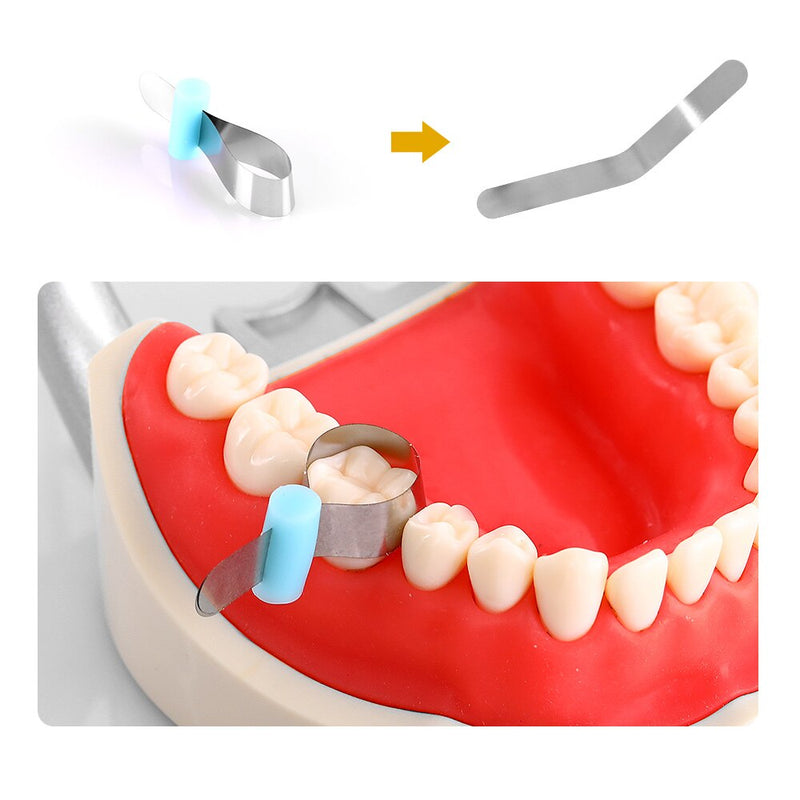 50pcs/Box Dental Forming Sheet Orthodontic Sectional Contoured Metal Matrice Polyester - KiwisLove