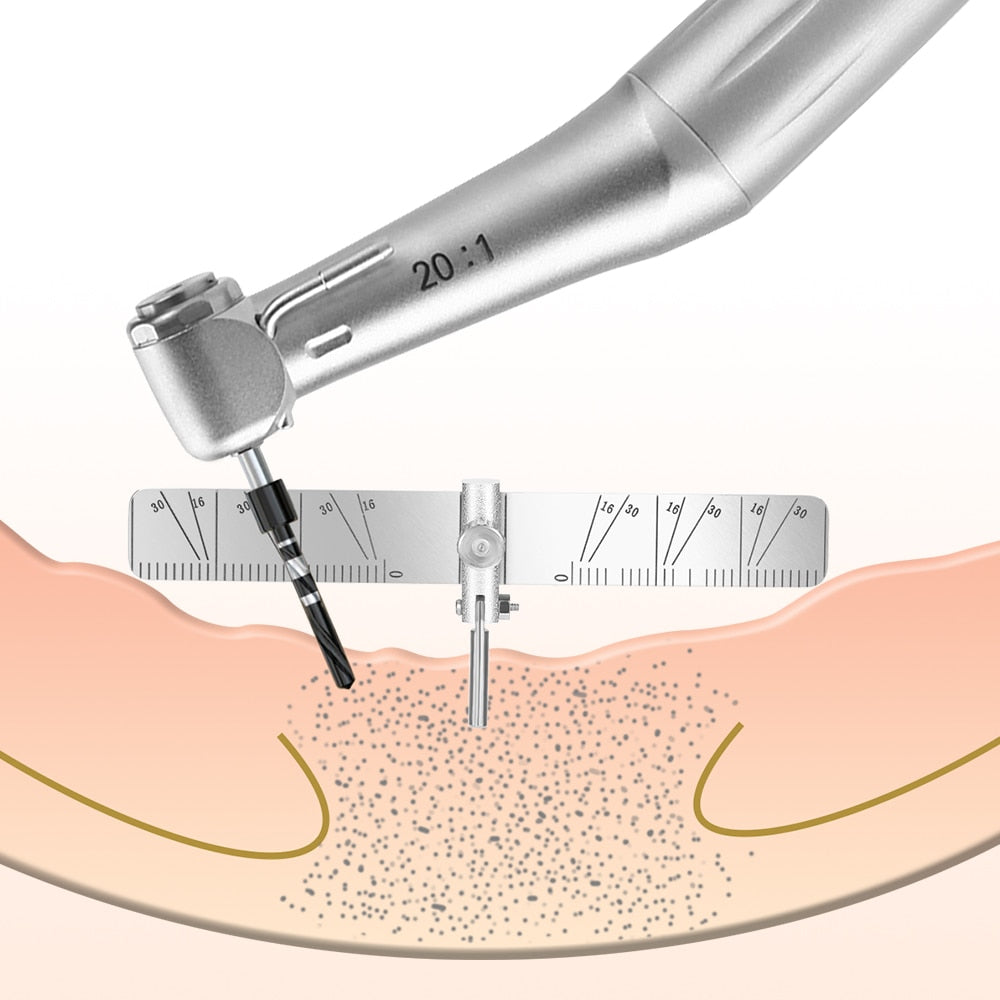 Dental Implant Locating Guide Surgical Planting Positioning Locator Angle Ruler Guage Autoclavable - KiwisLove