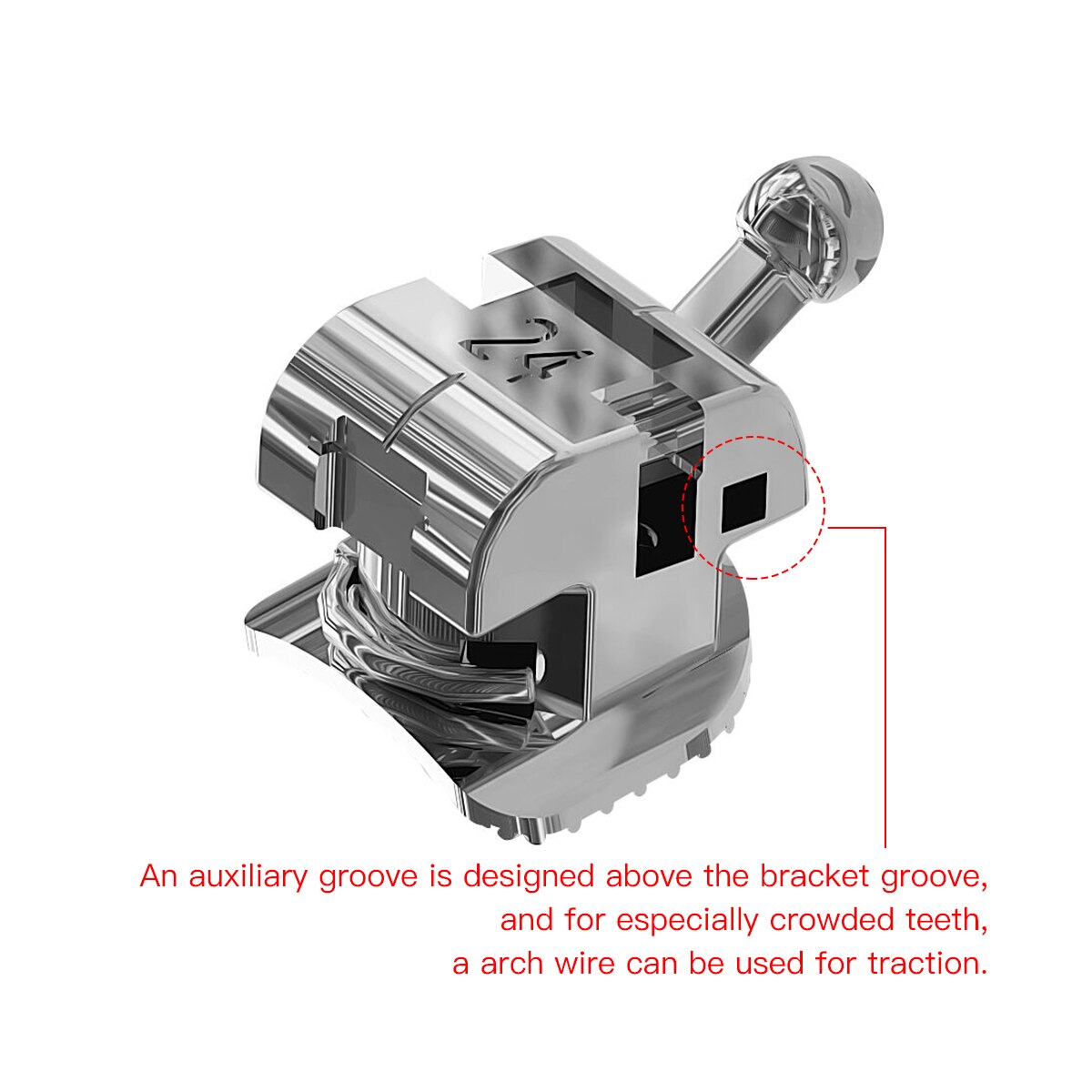 AZDENT Dental Metal Self-Ligating Brackets with Movable Hook Standard Turque Horizontal Auxiliary Slot Mesial Dista Adjustable - KiwisLove