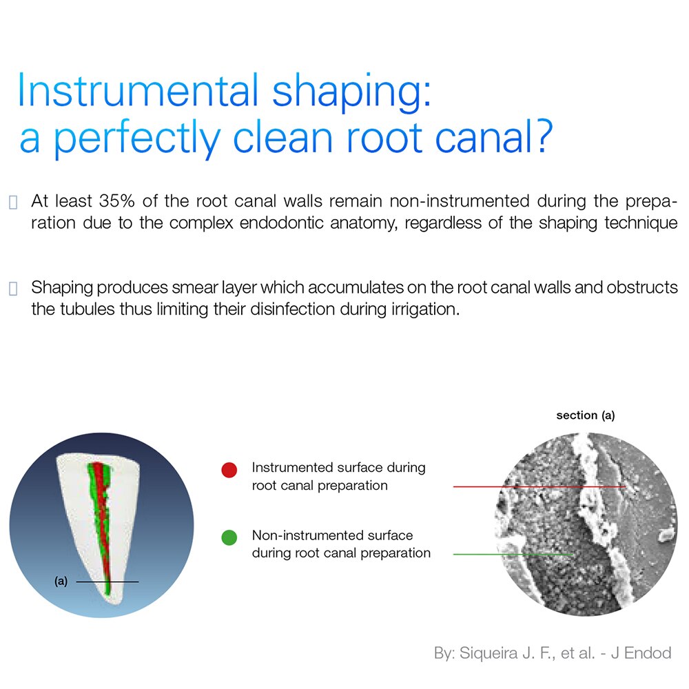 Dental Endo Ultra Activator Endo Irrigator Cordless Ultrasonic Activator Handpiece with 6 Tips 40-50Khz 1500mAh - KiwisLove