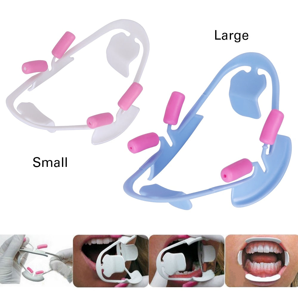 3D Oral Dental Mouth Opener Lip Retractor Orthodontic Professional Dentist Tools Dentistry Materials - KiwisLove