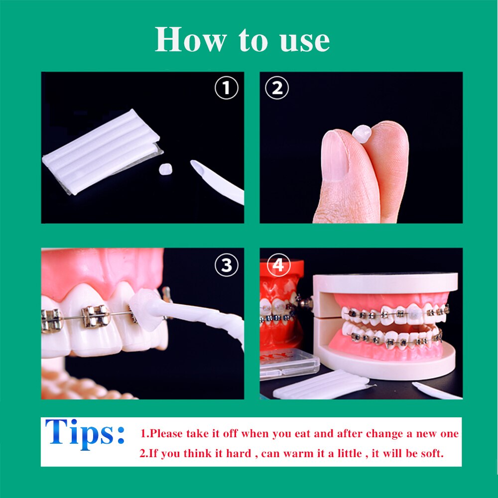 10pcs/ Box Dental Orthodontic  Bracket Patient Relief  Protect Lips and Gums - KiwisLove