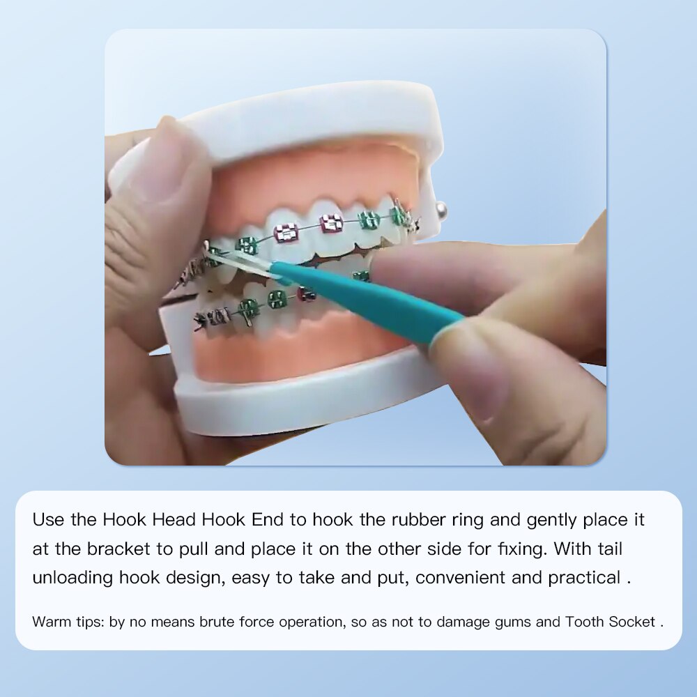 50PCS/PACK Dental Orthodontic Elastic Rubber Band Placers Random Color - KiwisLove