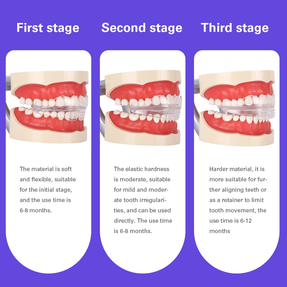 Dental Orthodontic Braces Appliances Kids Teeth Trainer Retainer Mouth Gard Tooth Tray Blue Purple Soft Hard - KiwisLove