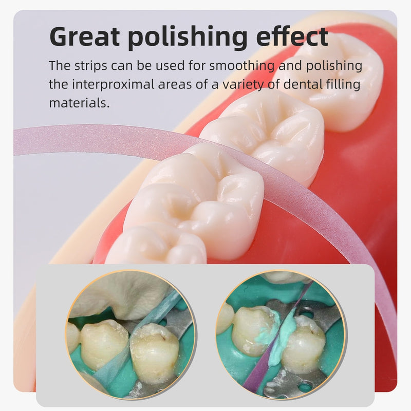 Dental Polishing Strip Roll 4mm Resin Tooth Grinding Sanding  Length-6m  Width-4mm 50μm 30μm20μm - KiwisLove