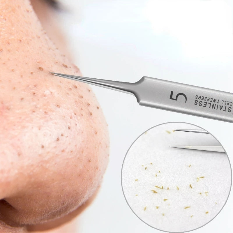 German Ultra-fine No. 5 Cell Pimples Blackhead Clip Tweezers Beauty Salon Special Scraping &amp; Closing Artifact Acne Needle Tool - KiwisLove