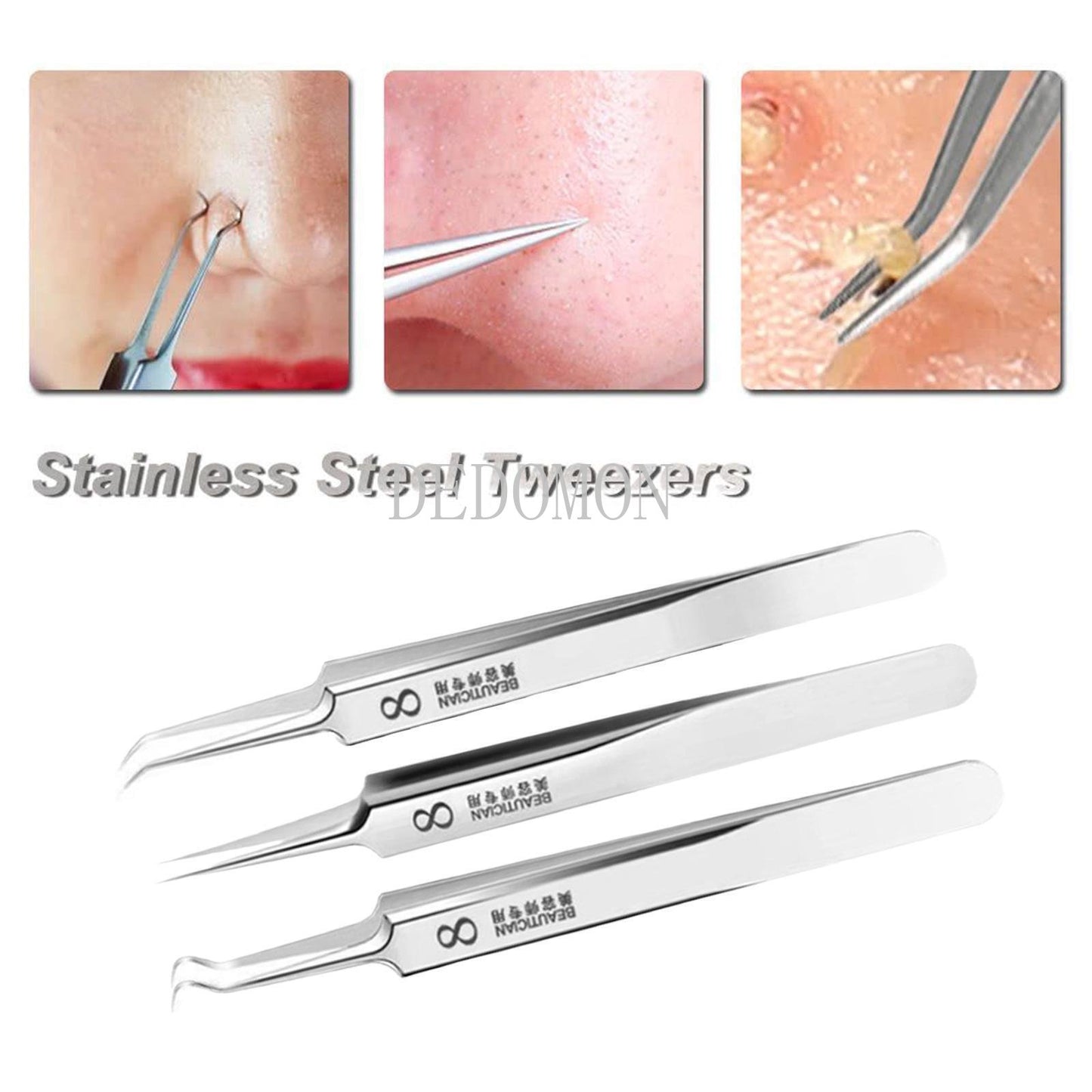 German Ultra-fine No. 5 Cell Pimples Blackhead Clip Tweezers Beauty Face Health Salon Special blackhead remover Acne Needle Tool - KiwisLove