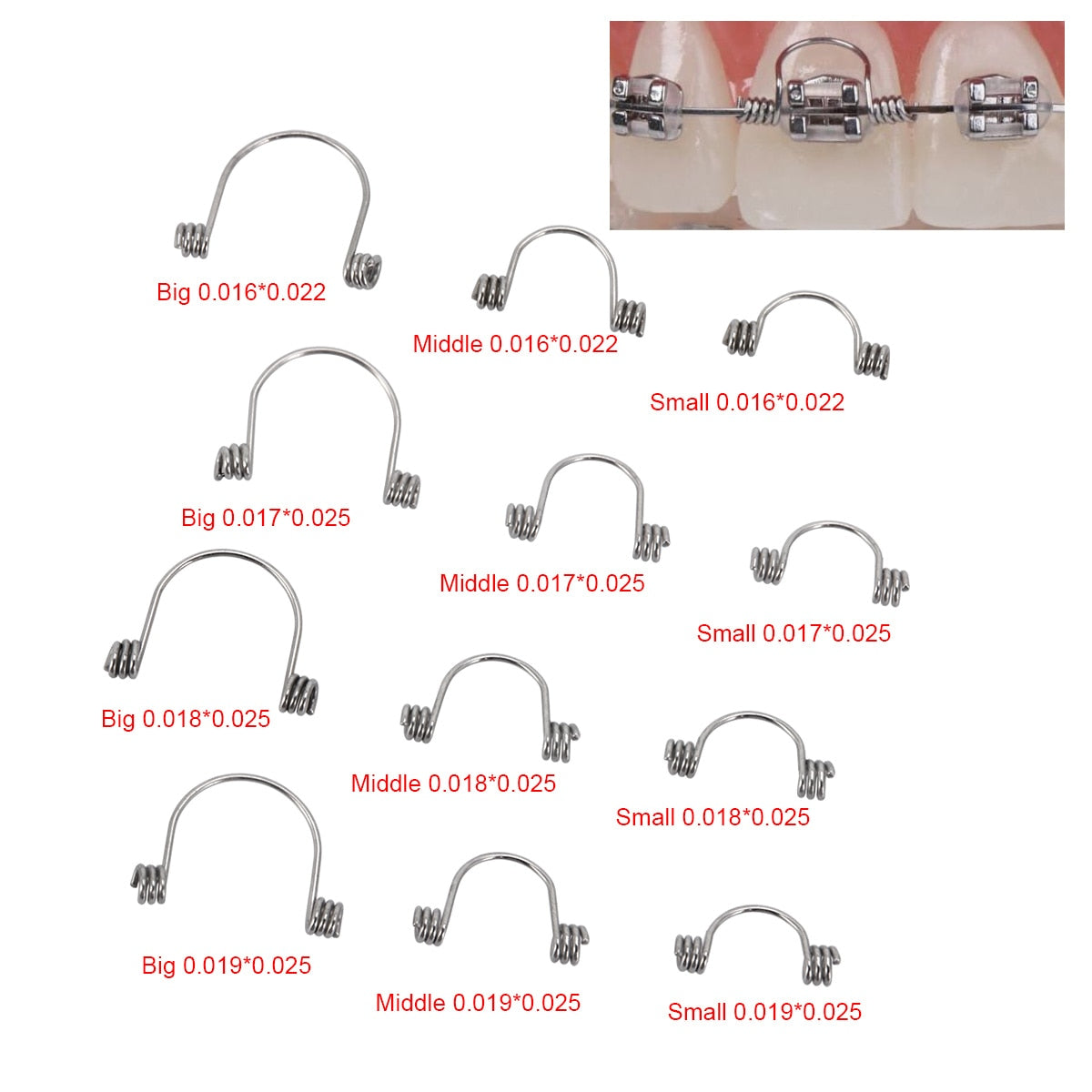 10Pcs/Bag Dental Orthodontic Torquing Spring Single Anterior Teeth Torque Stainless - KiwisLove