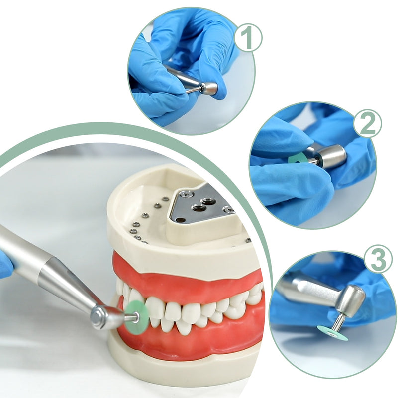 Azdent Dental Polishing Discs Gross Reduction Contouring Mandrel Stripes Set Materials Teeth Whitening - KiwisLove