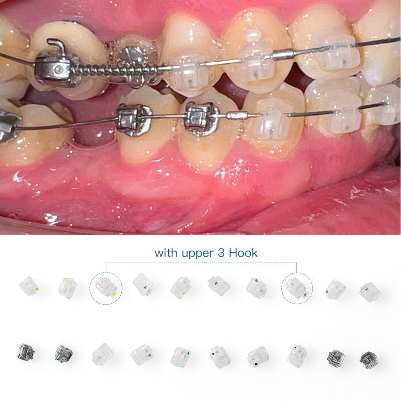 Dental Orthodontic Ceramic Self-Ligating Bracket Clear Roth &amp; MBT 0.022 5*5 3Hooks With Metal Lower 4 &amp; 5 - KiwisLove