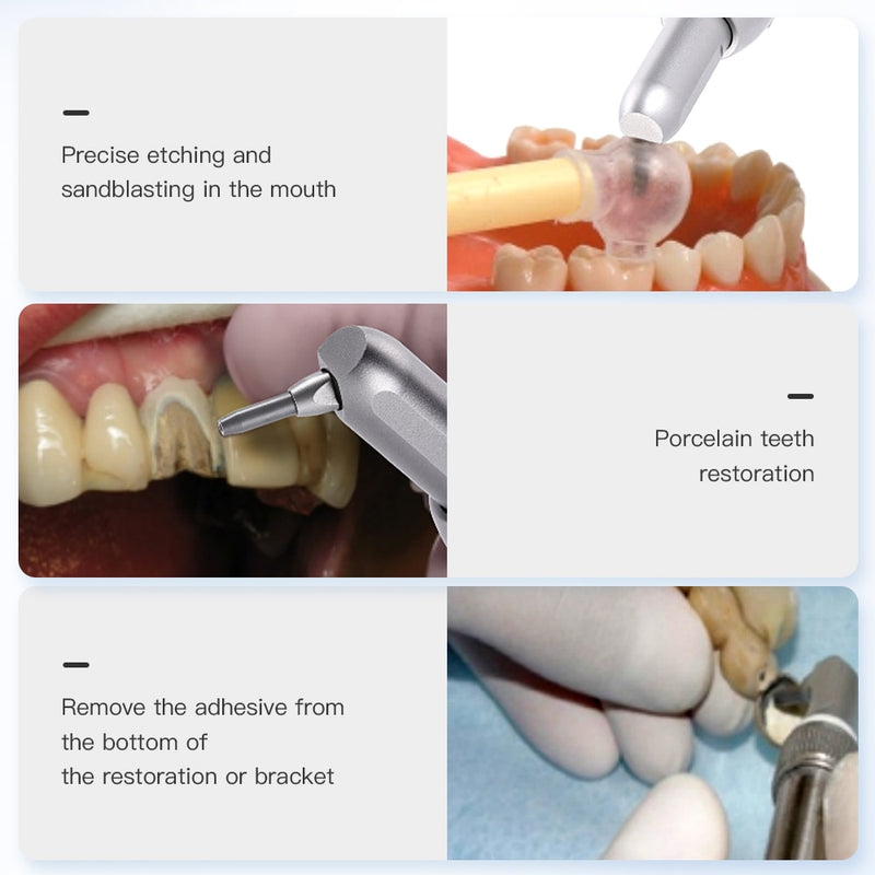 Azdent Dental Alumina Air Abrasion Polisher  Aluminum Oxide Micro Blaster Microetcher Sandblasting - KiwisLove