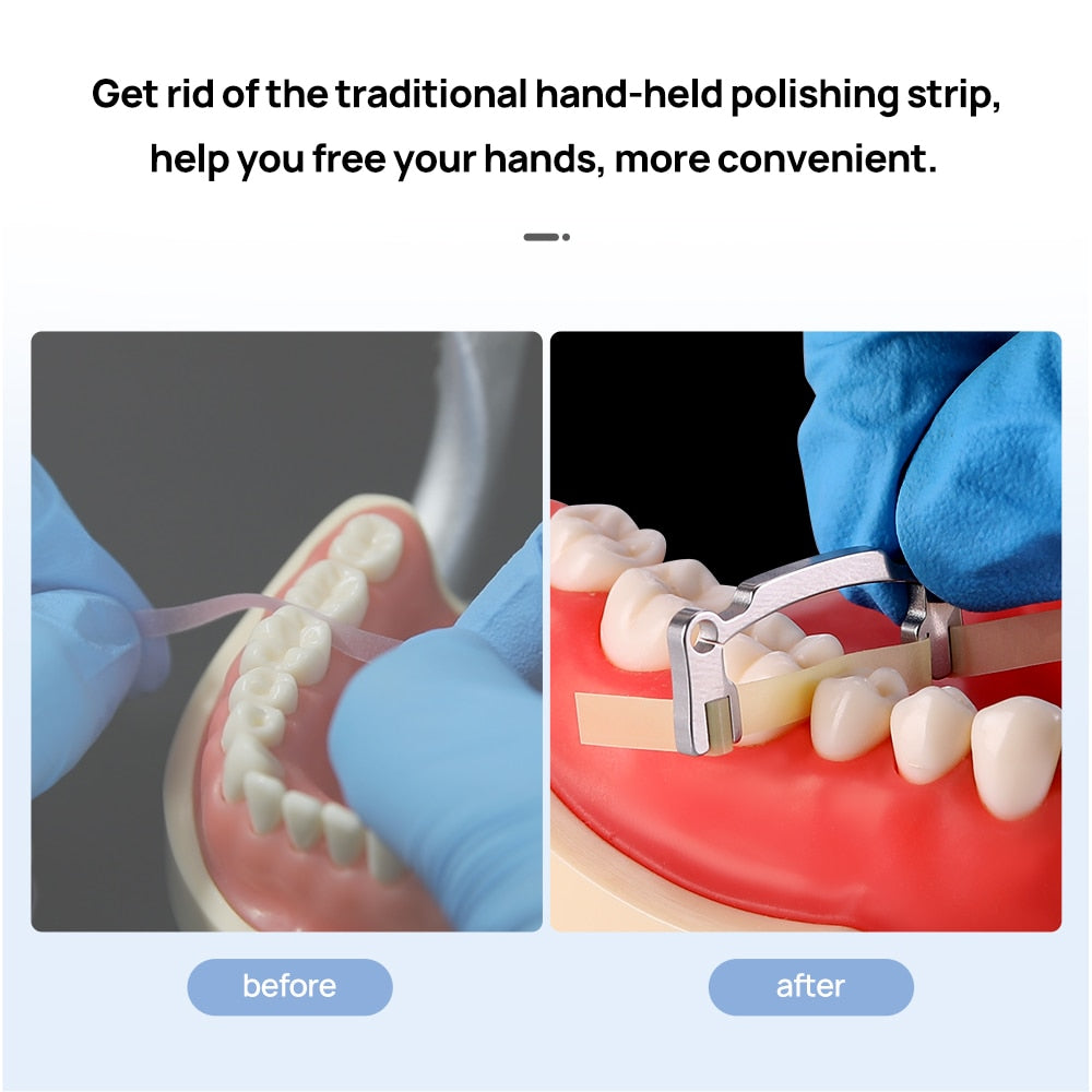 Azdent Dental Polishing Strip Holder Metal Resin  Autoclavable Dentist Tools - KiwisLove