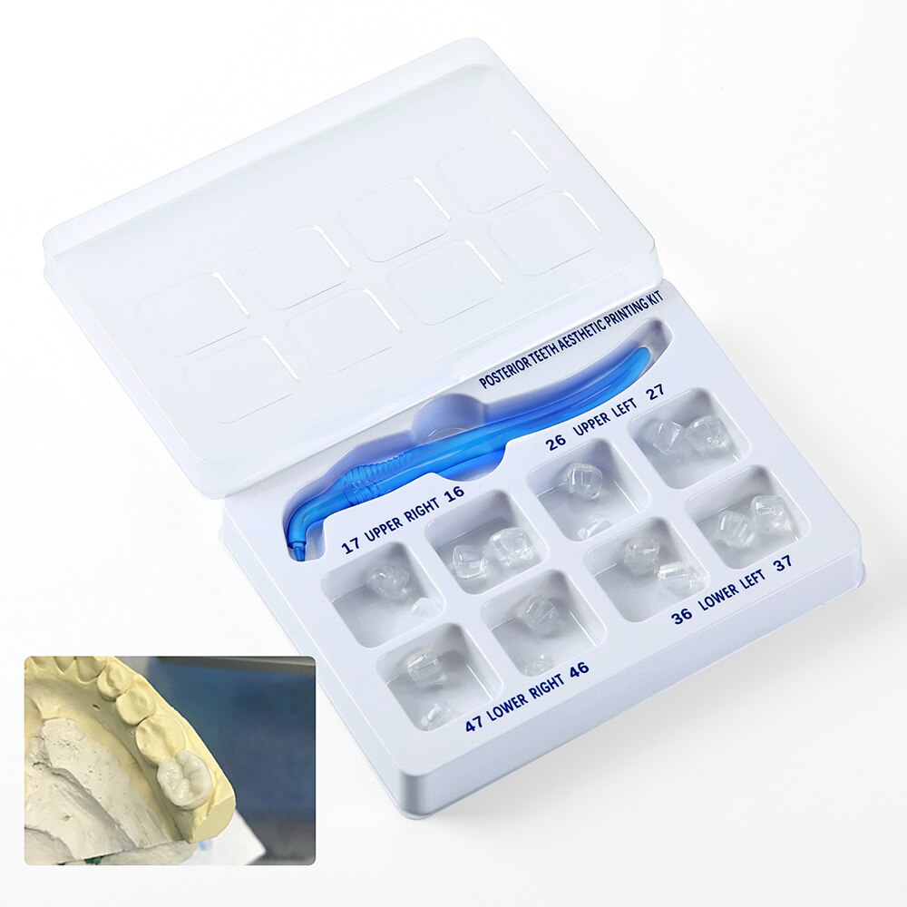 Dental Posterior Teeth Aesthetic Printing Mould Kit For Light Cure Composite Restoration Filling Tools - KiwisLove
