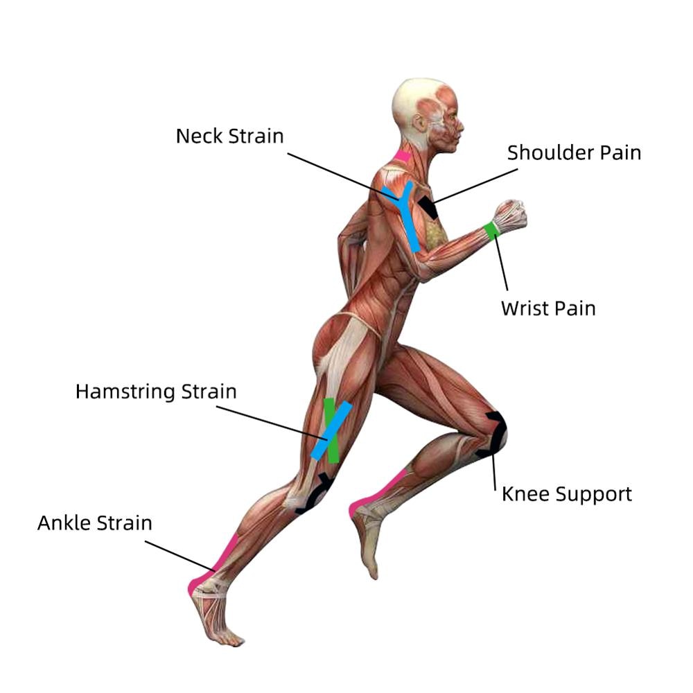 Kindmax Healthcare Cotton Elastic Athletic Kinesiology Tape, Adhesive Medical Bandage for Muscle Knee 5cmx5m Roll - KiwisLove