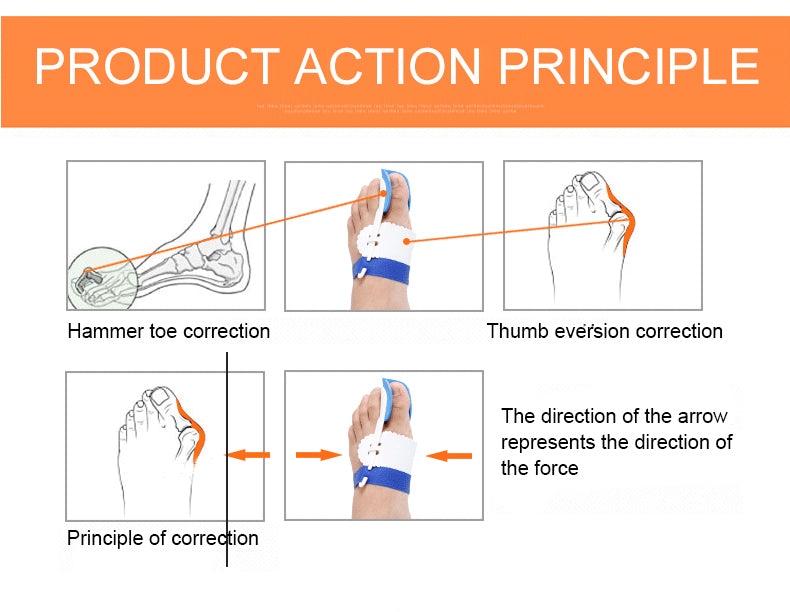 OPER 2Pcs Forefoot Bunion Hallux Valgus Orthopedic Braces Toe Thumb Postural - KiwisLove