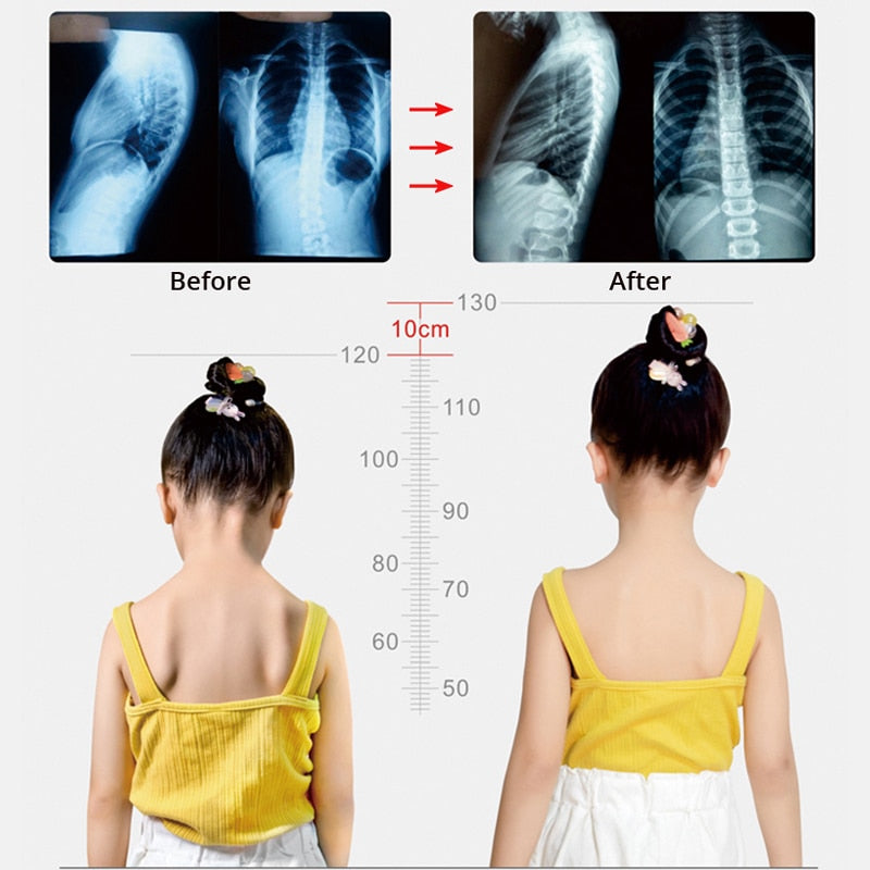 Electric Posture Corrector Back Support Trainer Spine Shoulder Correction - KiwisLove