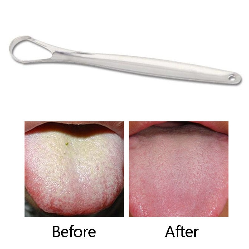1PC Useful Tongue Scraper Stainless Steel Oral Tongue Cleaner Medical Mouth Brush Reusable Fresh Breath Maker - KiwisLove