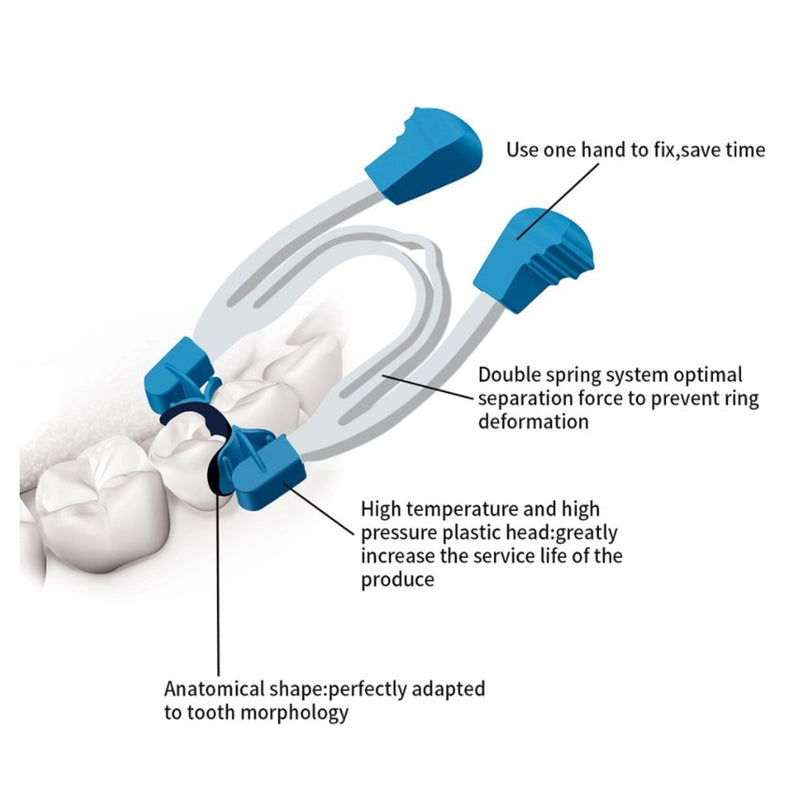 Dental Matrix Sectional Contoured Metal Spring Clip Sectional Matrix Rings - KiwisLove