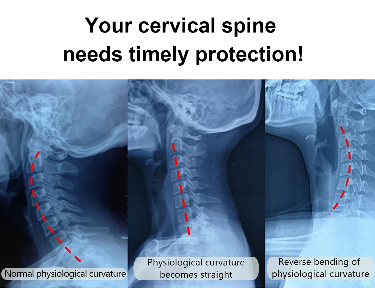 VELPEAU Neck Brace for Neck Pain and Support Soft Cervical Collar - KiwisLove