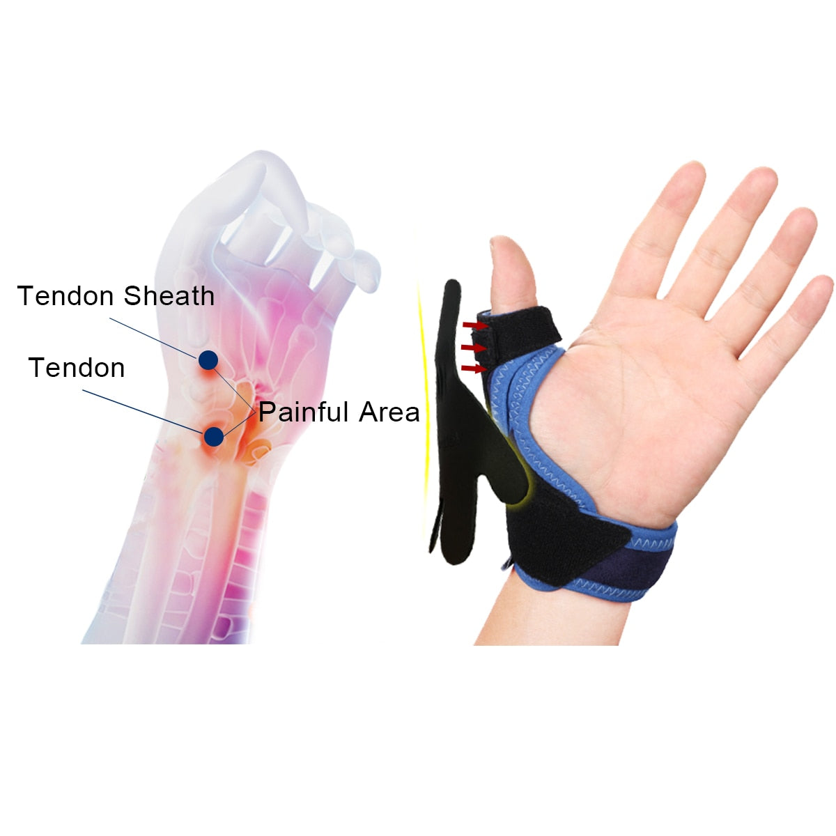 VELPEAU Tenosynovitis Thumb Protector for Mouse Hand Thumb Brace Light and Breathable - KiwisLove