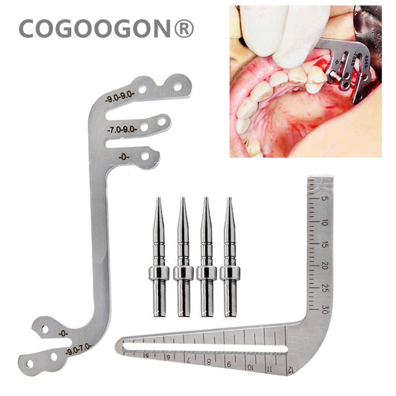 Dental Implant Guide Set Oral Planting Locator Positioning - KiwisLove