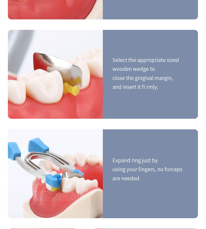 AZDENT Dental Matrix Sectional Contoured Matrices Clamps Wedges - KiwisLove