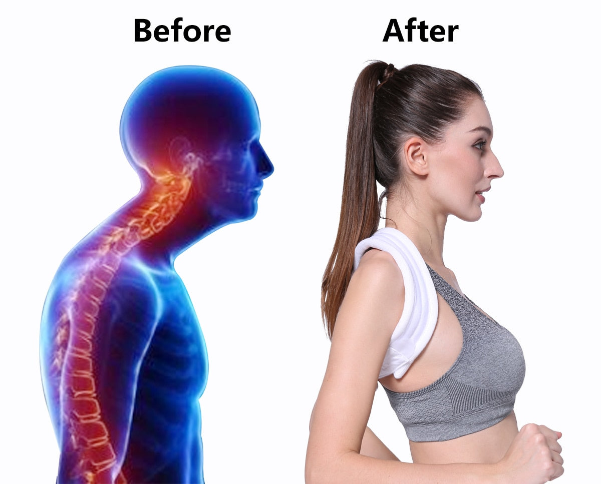 VELPEAU Posture Corrector Prevent Hunchback - KiwisLove