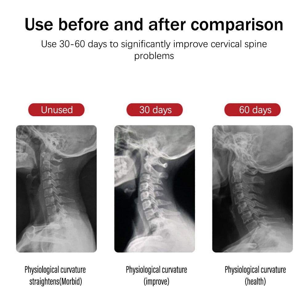 Yongrow Inflatable Cervical Neck Traction Adjustable Stretcher Collar - KiwisLove