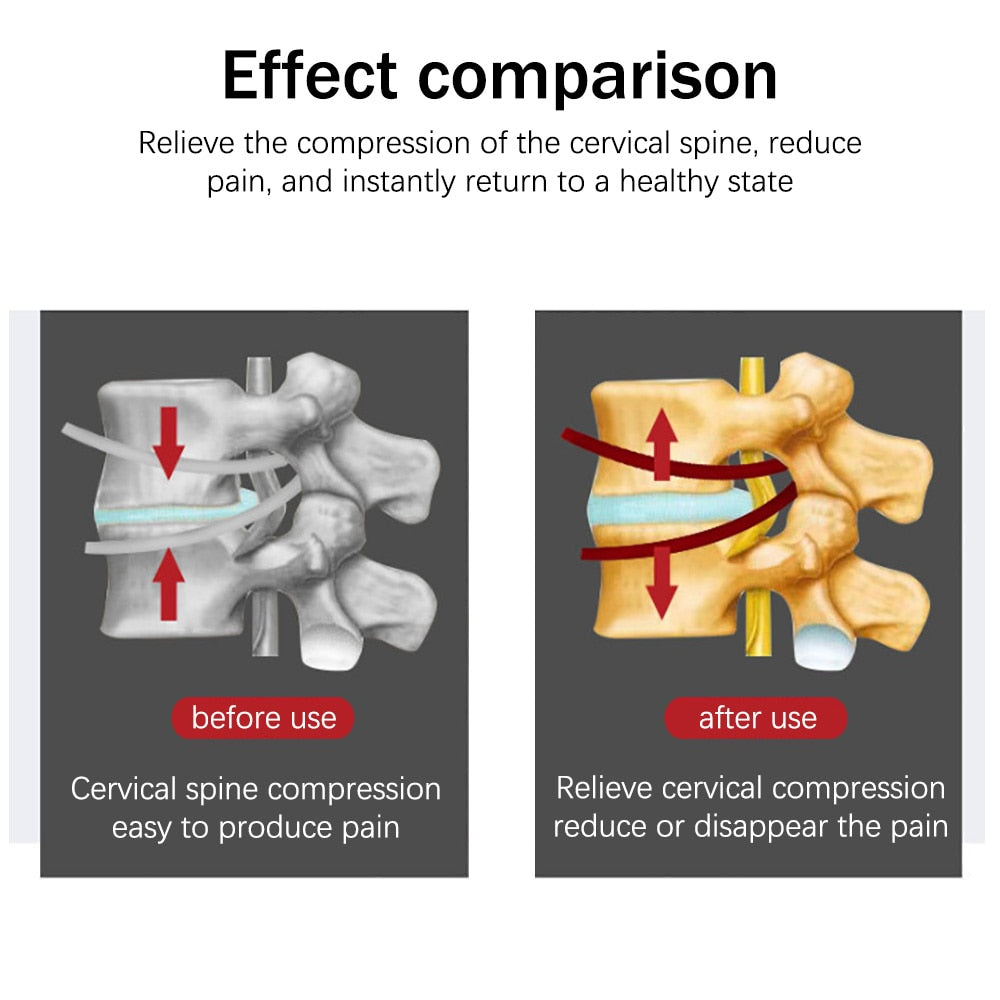 Yongrow Inflatable Cervical Neck Traction Adjustable Stretcher Collar - KiwisLove