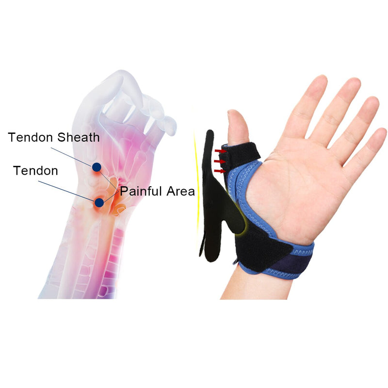 VELPEAU Thumb Splint with Wrist Support Brace Thumb Brace - KiwisLove