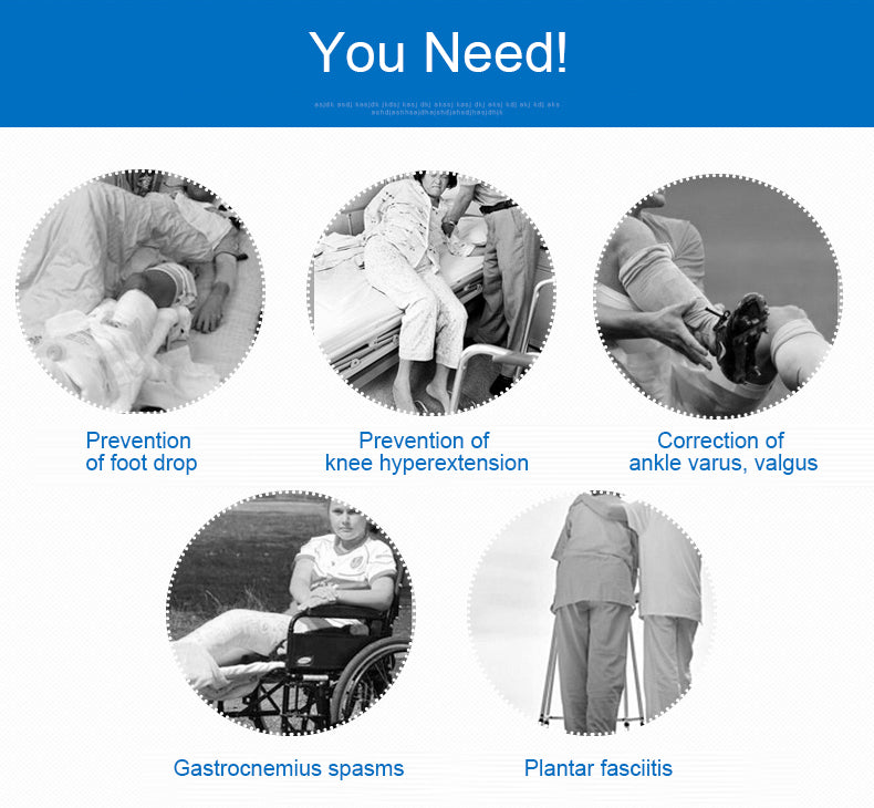 OPER Ankle Brace Support Foot Sprains Ankle Support Brace Ankle Fracture Rehabilitation - KiwisLove