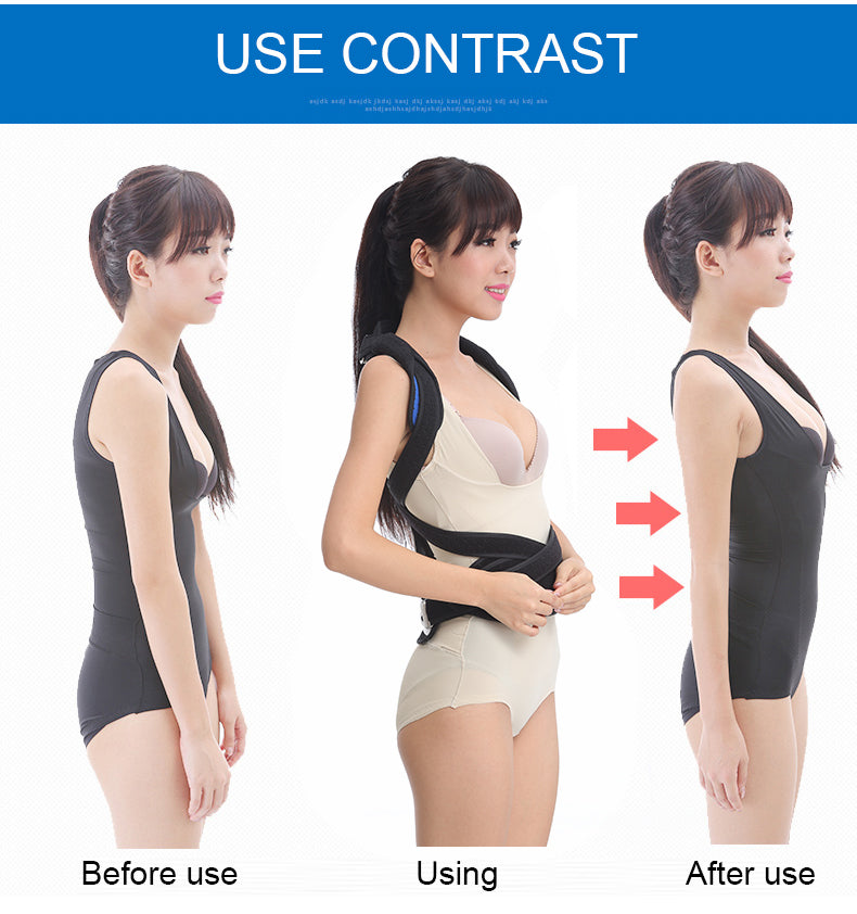 OPER Spinal Orthosis Fixation Thoracic Spine Kyphosis Correction - KiwisLove