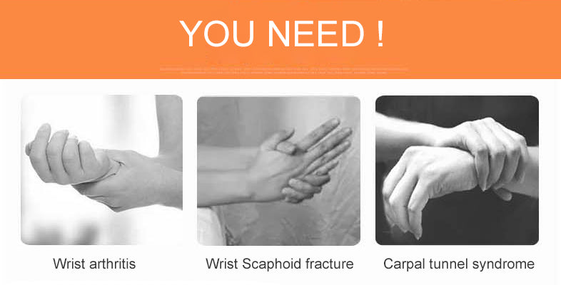 OPER Wrist Support Wrap Splint Brace Wrist Sprain Finger Correction - KiwisLove