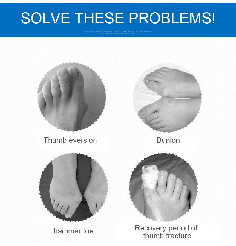OPER Correct posture big Toe Bunion Splint Straightener Stabilizer Corrector - KiwisLove