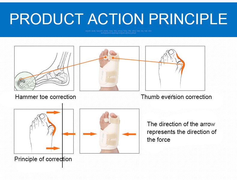 OPER Correct posture big Toe Bunion Splint Straightener Stabilizer Corrector - KiwisLove