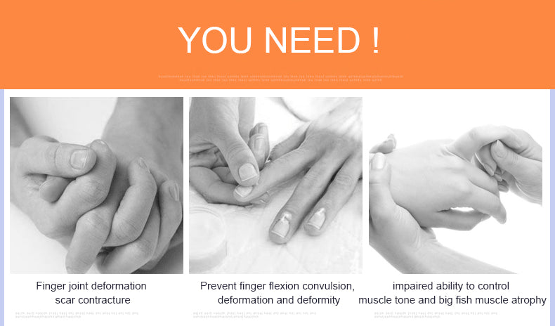 OPER Hand Finger Orthosis Split Finger support Reflex Stroke Hemiplegic - KiwisLove